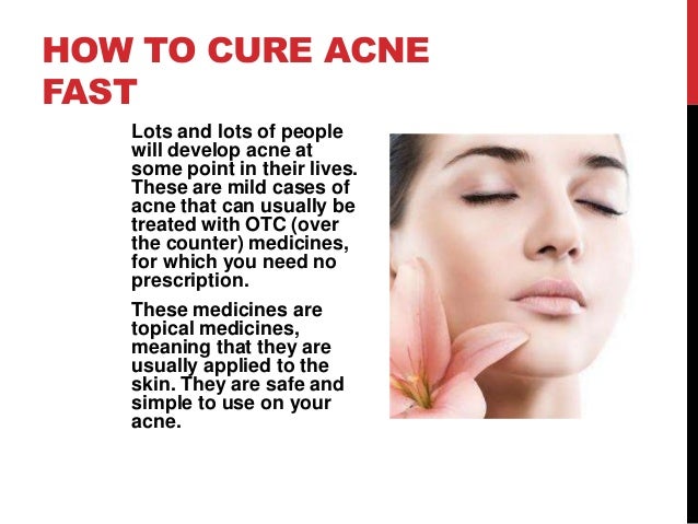 Acne How Overnight Get Of To Acne How Overnight Get Of To